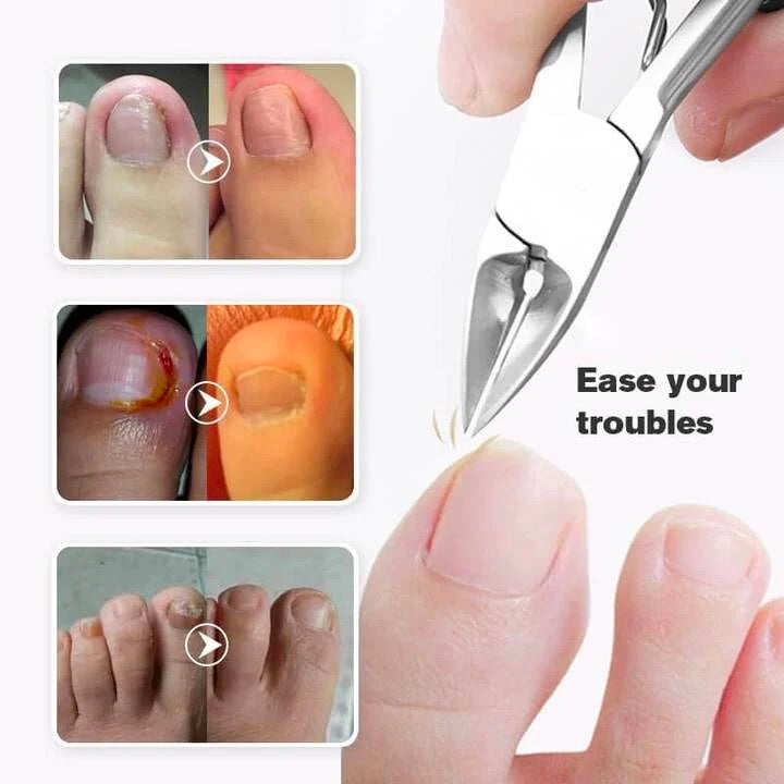 Medical-grade Nail Clippers🔥USA Fast Delivery🔥(48% OFF )